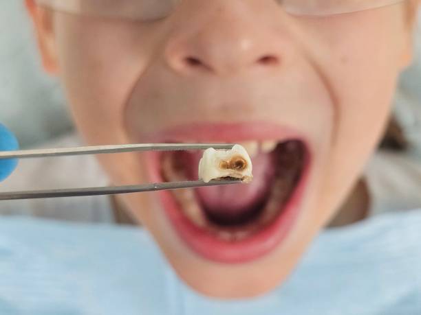 Best Orthodontic Emergency Dentist in Rock Valley, IA