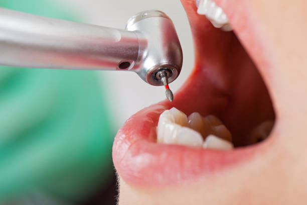 Best Broken or Cracked Tooth Emergency Dentist in Rock Valley, IA
